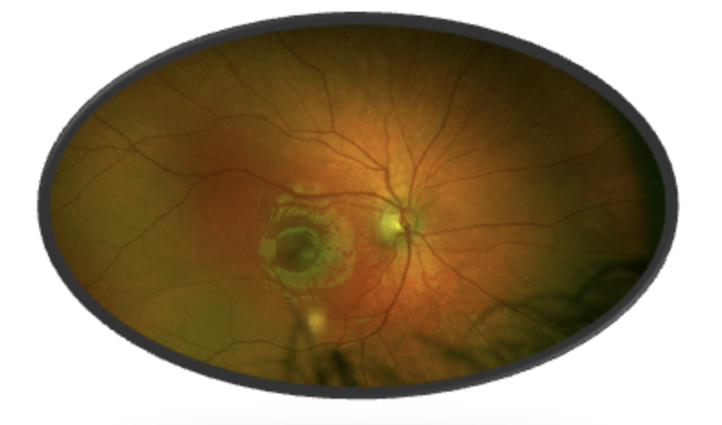 Ophthalmological findings 