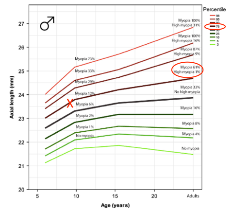 Axial lenght measurement: 23,83 / 23,66